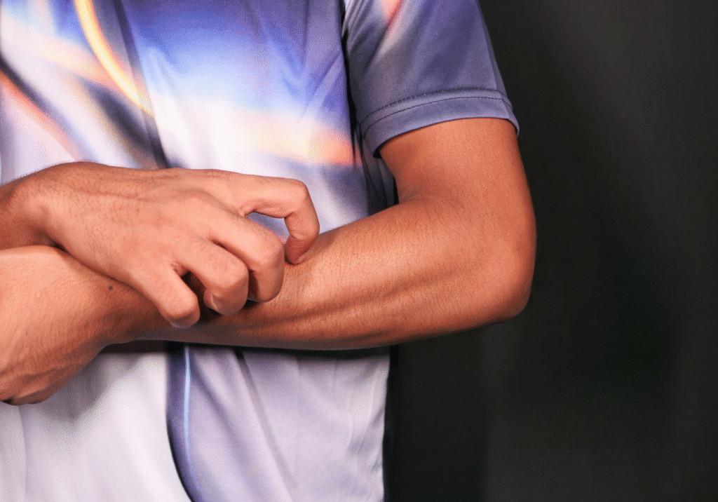 Dermatites: 8 tipos para conhecer 10 dermatite geralmente tem vermelhidão e causam prurido no local da lesão