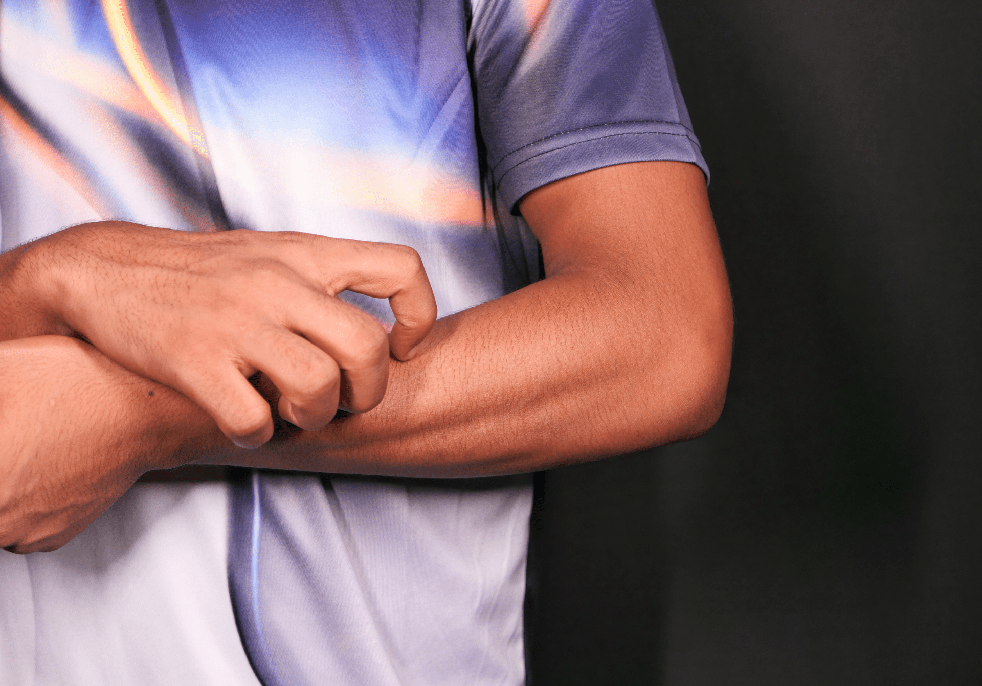 Blog 3 dermatite geralmente tem vermelhidão e causam prurido no local da lesão